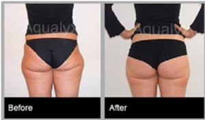 aqualyx-slider-11-300x176