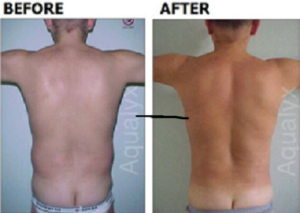 aqualyx-slider-22-300x213