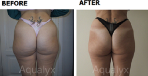 aqualyx-slider-33-300x155