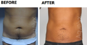 aqualyx-slider-44-300x155