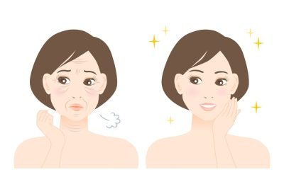 wrinkles-and-finelines-min